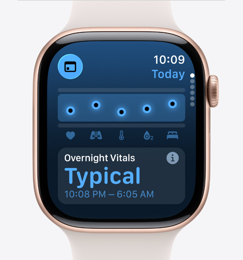 Apple Watch Series 11, aluminium case, rose gold colour, Vitals app, health score chart, overnight vitals notification, Sport Band, light blush colour