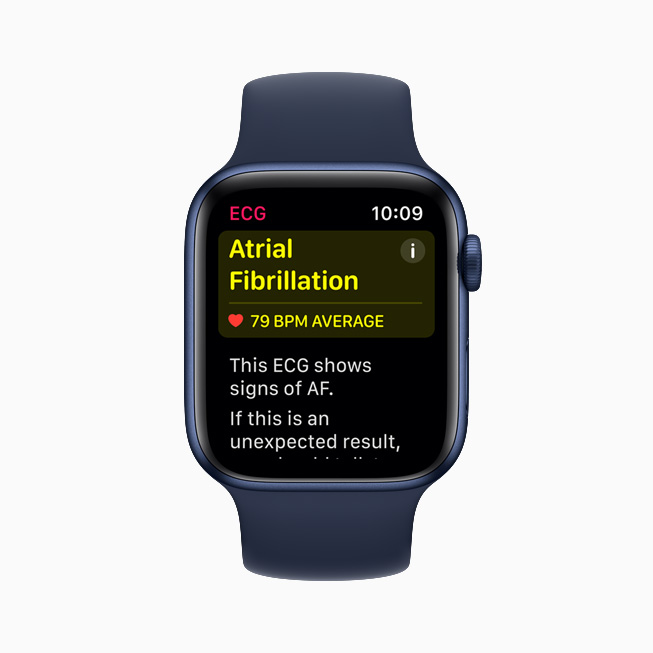 Sinus rhythm classification displayed in the ECG app on Apple Watch Series 6. 