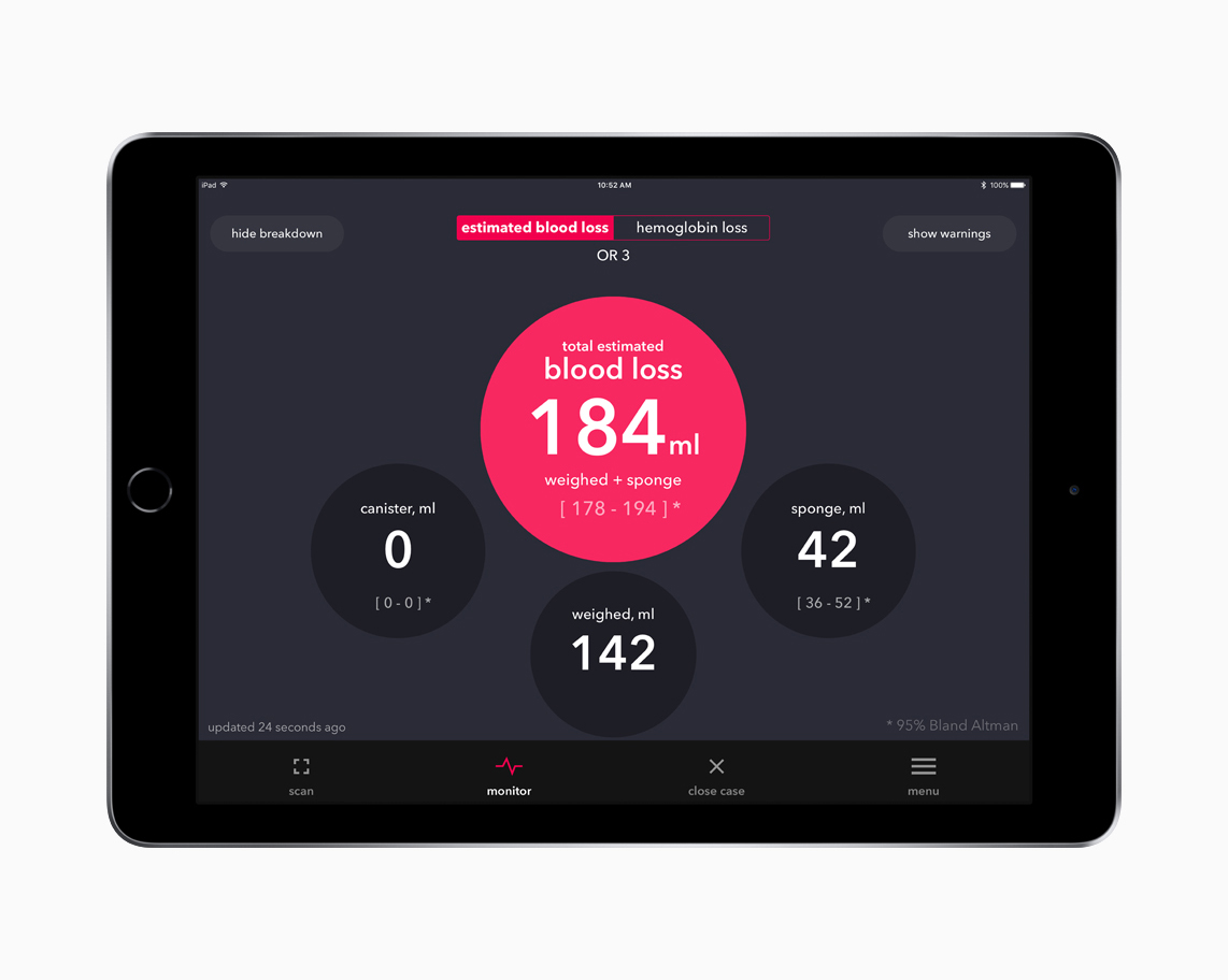 iPad, Triton Sponge’da kullanılan kan kaybı takip yazılımını gösteriyor