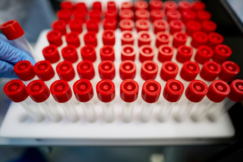 صينية قوارير العينات، جزء من مجموعات أدوات جمع العينات الخاص بشركة COPAN Diagnostics. 
