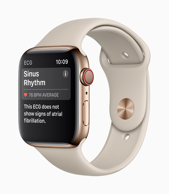 Ekranında bir Sinüs Ritmi görülen Apple Watch Series 4. 