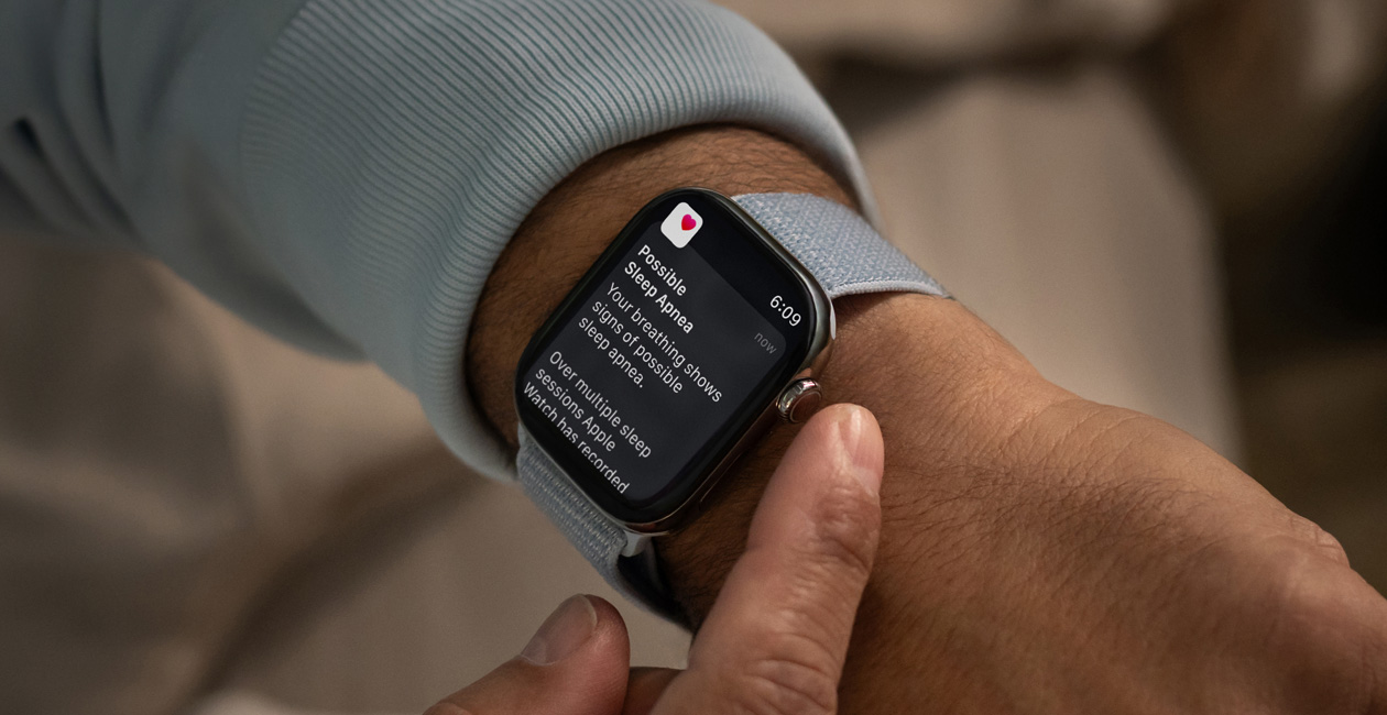 En Apple Watch som viser varslingen Mulig søvnapné.